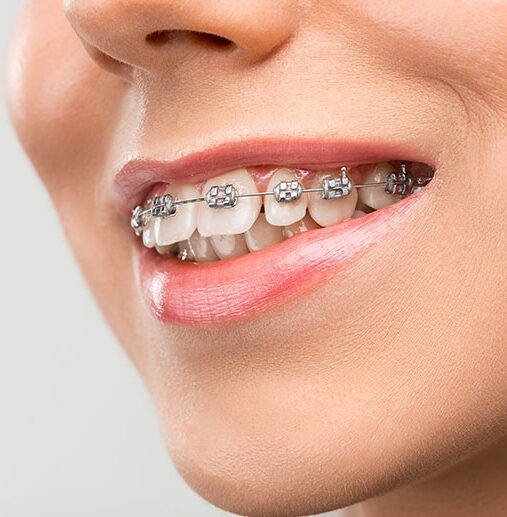 Ortodontik Tedaviler