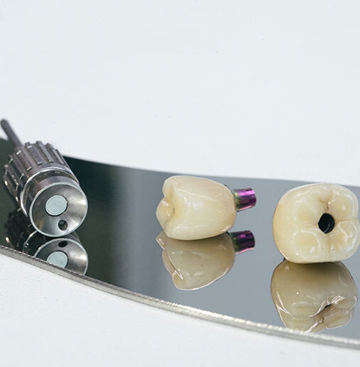 Immediate İmplant Tedavileri