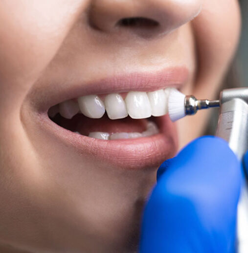 Diş Taşı Temizliği